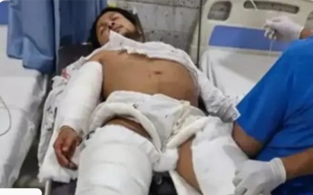 इंडियन आइडल 12’ के पवनदीप राजन की सड़क हादसे में गंभीर चोट, नोएडा में चल रहा इलाज