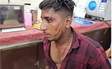 सूरजपुर: साल्वेंट प्लांट में 25 लाख की लूट, संचालक से मारपीट कर सिर पर गंभीर चोट, भीड़ ने की तोड़फोड़