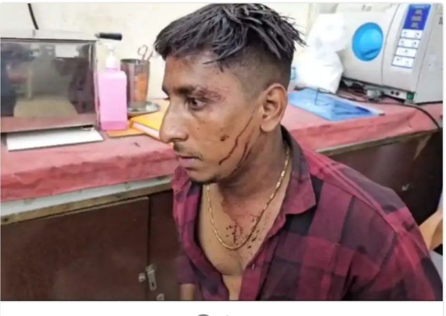 सूरजपुर: साल्वेंट प्लांट में 25 लाख की लूट, संचालक से मारपीट कर सिर पर गंभीर चोट, भीड़ ने की तोड़फोड़