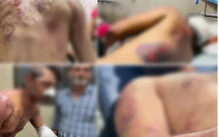 अलीगढ़ में भीड़ का हमला: मवेशी मांस की आशंका में चार लोगों की पिटाई, वाहन में तोड़फोड़ और आगजनी