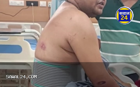 छत्तीसगढ़: बिलासपुर के कोटा वन क्षेत्र में लकड़ी तस्करों का कहर, डिप्टी रेंजर पर कुल्हाड़ी से जानलेवा हमला